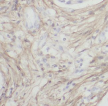 LTBP1 Rabbit Polyclonal Antibody