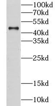 LTBR Rabbit Polyclonal Antibody