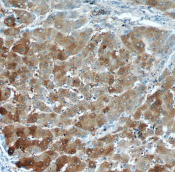 LTBR Rabbit Polyclonal Antibody