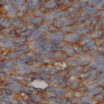 LY6E Rabbit Polyclonal Antibody
