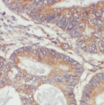 LYPLA1 Rabbit Polyclonal Antibody