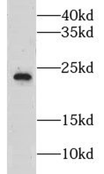 LZIC Rabbit Polyclonal Antibody