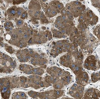 MACC1 Rabbit Polyclonal Antibody