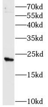 MAD2L1 Mouse Monoclonal Antibody