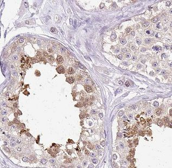 MAD2L1 Mouse Monoclonal Antibody