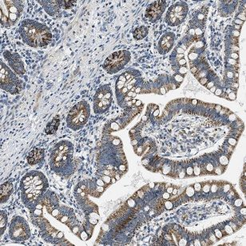 MADCAM1 Rabbit Polyclonal Antibody