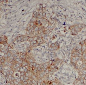 MAEA Rabbit Polyclonal Antibody