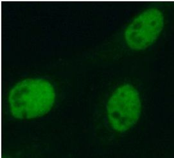 MAF Rabbit Polyclonal Antibody