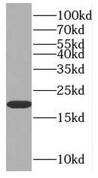 MAFF Rabbit Polyclonal Antibody