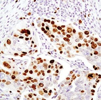 MAFF Rabbit Polyclonal Antibody
