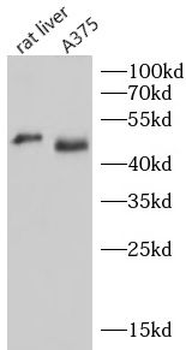 MAGEA4 Rabbit Polyclonal Antibody