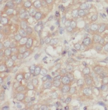 MAGEA4 Rabbit Polyclonal Antibody