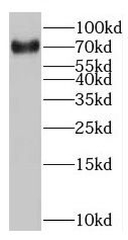 MAGEC3 Rabbit Polyclonal Antibody