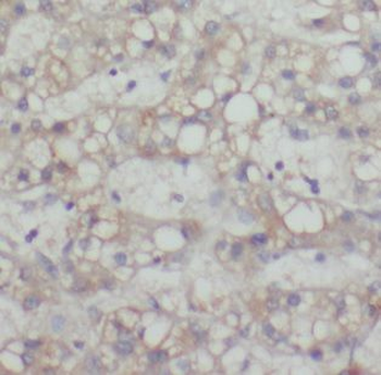 MAGEC3 Rabbit Polyclonal Antibody