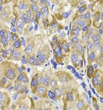 MAGED1 Rabbit Polyclonal Antibody