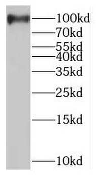 MAGED1 Rabbit Polyclonal Antibody