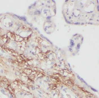 MAGED1 Rabbit Polyclonal Antibody
