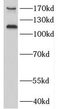MAGI1 Rabbit Polyclonal Antibody
