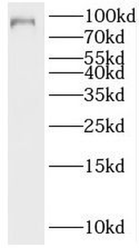 MALT1 Rabbit Polyclonal Antibody