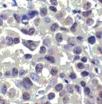 MALT1 Rabbit Polyclonal Antibody