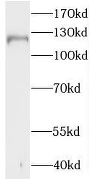 MAML3 Rabbit Polyclonal Antibody