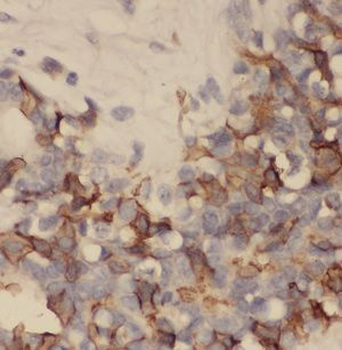 SCGB2A2 Rabbit Polyclonal Antibody