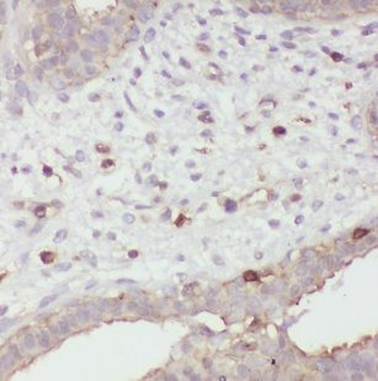 SCGB2A2 Rabbit Polyclonal Antibody