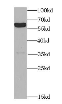 MAOA Rabbit Polyclonal Antibody