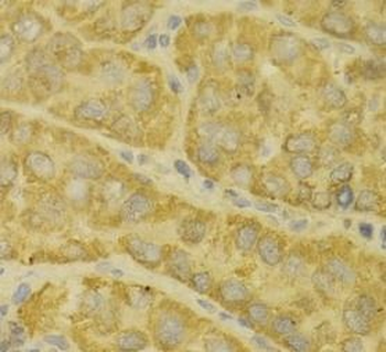 MAOA Rabbit Polyclonal Antibody