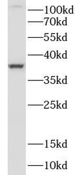 MAP2K6 Rabbit Polyclonal Antibody