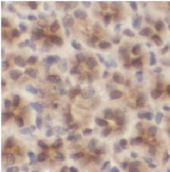 MAP2K6 Rabbit Polyclonal Antibody