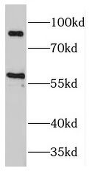MAP4K2 Rabbit Polyclonal Antibody