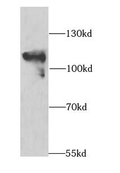MAP4K3 Rabbit Polyclonal Antibody