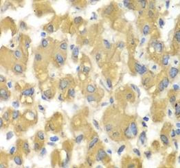 MAP4K3 Rabbit Polyclonal Antibody