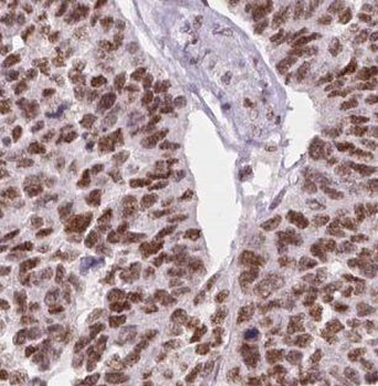 MAP4K5 Rabbit Polyclonal Antibody