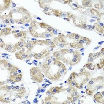 MAPKBP1 Rabbit Polyclonal Antibody