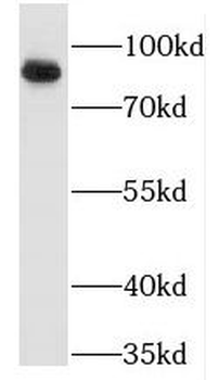 MARCKS Rabbit Polyclonal Antibody