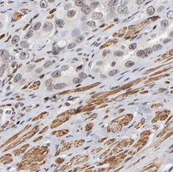 MARCKS Rabbit Polyclonal Antibody