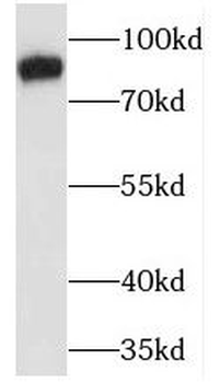 MARCKS Rabbit Polyclonal Antibody