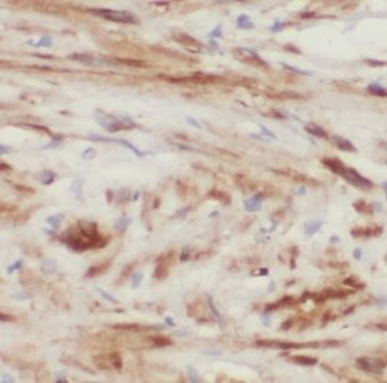MARCKS Rabbit Polyclonal Antibody