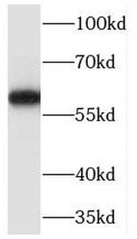 MARCKSL1 Rabbit Polyclonal Antibody