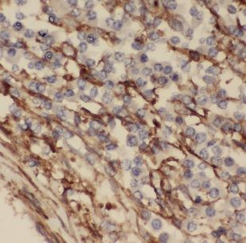 MARCKSL1 Rabbit Polyclonal Antibody
