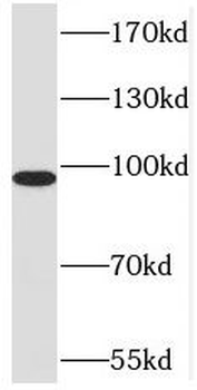 MATR3 Rabbit Polyclonal Antibody