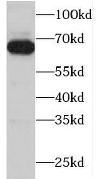 MBD4 Rabbit Polyclonal Antibody
