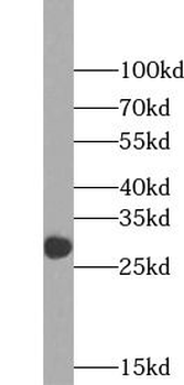 MBL2 Rabbit Polyclonal Antibody