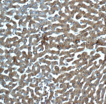 MBL2 Rabbit Polyclonal Antibody