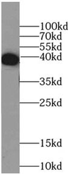 MBP Tag Rabbit Polyclonal Antibody