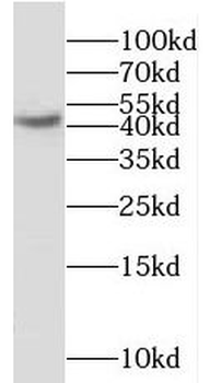 MCHR1 Rabbit Polyclonal Antibody