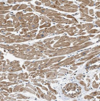 MCHR1 Rabbit Polyclonal Antibody