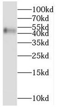 MCHR1 Rabbit Polyclonal Antibody